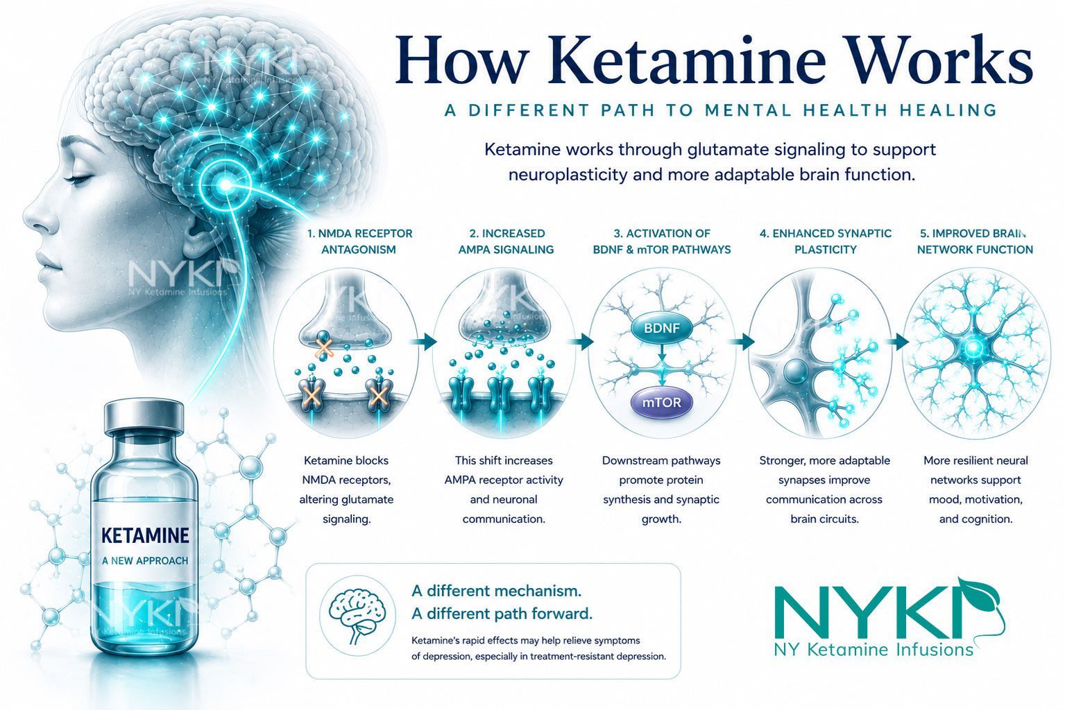 How Ketamine Works For Depression How Ketamine Works For Depression Nyki