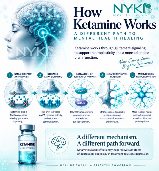 How Ketamine Works For Mental Health Treatment At Ny Ketamine Infusions